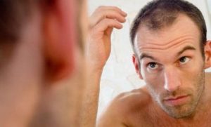 caduta- capelli-come-scegliere-un-centro-affidabile